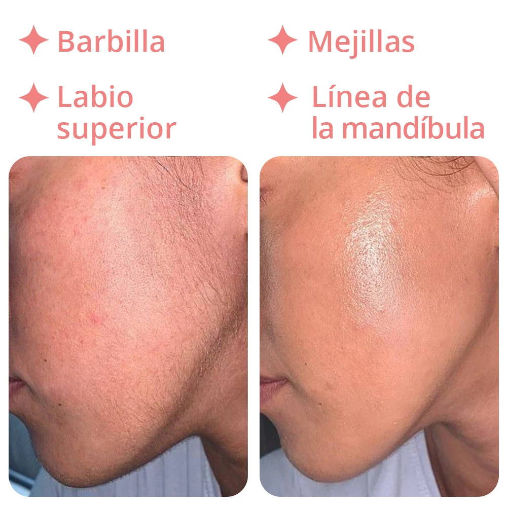 Depiladora 18K - Removedor de Vello Facial Pro